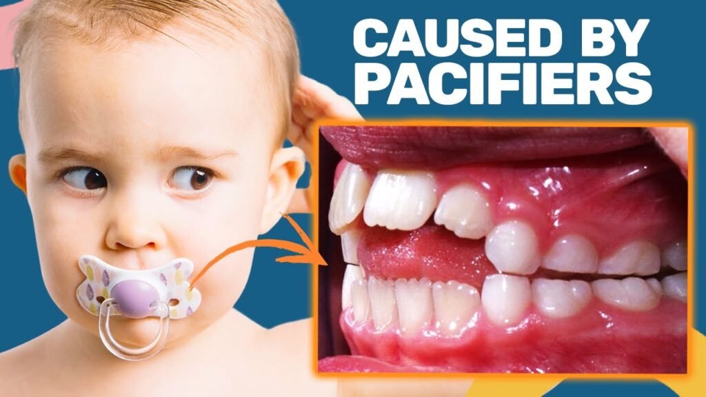 The Dental Risks of Improper Pacifier Use